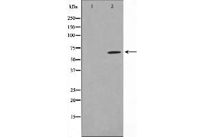 Western blot analysis on MDA-MB-435 cell lysate using PIAS1 Antibody,The lane on the left is treated with the antigen-specific peptide. (PIAS1 Antikörper  (N-Term))