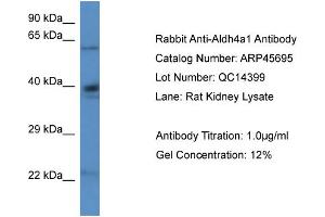 Western Blotting (WB) image for anti-Aldehyde Dehydrogenase 4 Family, Member A1 (ALDH4A1) (N-Term) antibody (ABIN2782322) (ALDH4A1 Antikörper  (N-Term))