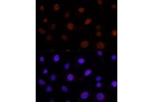 Immunofluorescence analysis of L-929 cells using GLI2 antibody (ABIN7267384) at dilution of 1:100. (GLI2 Antikörper)