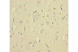 Immunohistochemistry of paraffin-embedded human brain tissue using ABIN7175654 at dilution of 1:100 (VWF Antikörper  (AA 1-273))