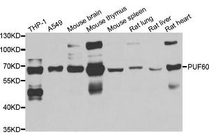 Western blot analysis of extracts of various cell lines, using PUF60 antibody (ABIN5974052) at 1/1000 dilution. (PUF60 Antikörper)
