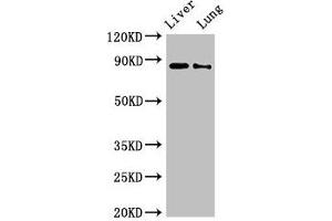 Western Blot Positive WB detected in: Rat liver tissue, Rat lung tissue All lanes: DENND1C antibody at 3 μg/mL Secondary Goat polyclonal to rabbit IgG at 1/50000 dilution Predicted band size: 88, 83 kDa Observed band size: 88 kDa