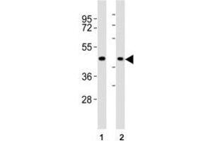 Western blot testing of CCR1 antibody at 1:2000 dilution. (CCR1 Antikörper  (AA 13-44))