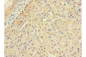 Immunohistochemistry (IHC) image for anti-Ceramide Kinase-Like (CERKL) (AA 1-558) antibody (ABIN7147459)