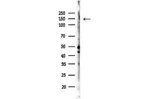 anti-Lysine (K)-Specific Demethylase 3A (KDM3A) (pTyr1114) antibody