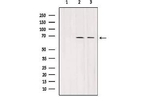 Western blot analysis of extracts from various samples, using SLC7A3 Antibody. (SLC7A3 Antikörper  (Internal Region))
