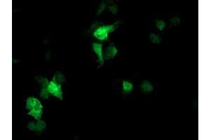 Anti-FBXO21 mouse monoclonal antibody (ABIN2455370) immunofluorescent staining of COS7 cells transiently transfected by pCMV6-ENTRY FBXO21 (RC223095). (FBXO21 Antikörper)