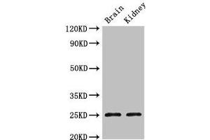 Western Blot Positive WB detected in: Mouse brain tissue, Mouse kidney tissue All lanes: CLDN10 antibody at 2. (Claudin 1 Antikörper  (AA 185-224))