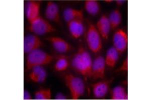 Image no. 3 for anti-Mitogen-Activated Protein Kinase Kinase Kinase 5 (MAP3K5) (Ser83) antibody (ABIN197310) (ASK1 Antikörper  (Ser83))
