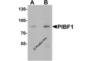 Western Blotting (WB) image for anti-Progesterone Immunomodulatory Binding Factor 1 (PIBF1) (C-Term) antibody (ABIN1077444) (PIBF1 Antikörper  (C-Term))
