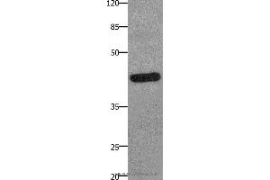 Western blot analysis of A549 cell, using PTGER2 Polyclonal Antibody at dilution of 1:100 (PTGER2 Antikörper)