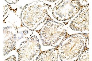 ABIN6259219 and ABIN6274143 at 1/100 staining Rat testis tissue by IHC-P. (TOP3B Antikörper  (C-Term))