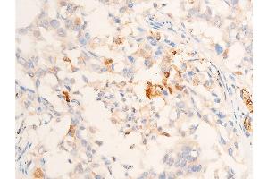Immunohistochemistry (IHC) image for anti-Transforming Growth Factor, beta 1 (TGFB1) (C-Term) antibody (ABIN6266431)