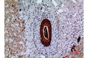 Immunohistochemistry (IHC) image for anti-Protein tyrosine Phosphatase, Receptor Type, J (PTPRJ) (Internal Region) antibody (ABIN6285228)