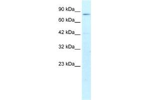WB Suggested Anti-CREBL1 Antibody Titration:  1. (ATF6B Antikörper  (N-Term))
