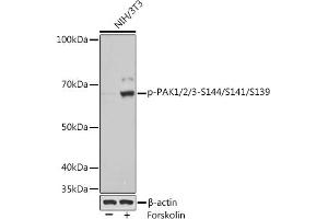 Western blot analysis of extracts of various cell lines, using Phospho-P/2/3-S144/S141/S139 Rabbit mAb (ABIN7269150) at 1:1000 dilution. (PAK1/2/3 Antikörper  (pSer139, pSer141, pSer144))