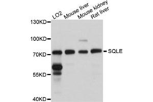 Western blot analysis of extracts of various cells, using SQLE antibody.