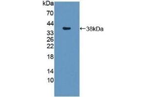 Detection of Recombinant SNTb1, Mouse using Polyclonal Antibody to Syntrophin Beta 1 (SNTb1) (SNTB1 Antikörper  (AA 2-297))