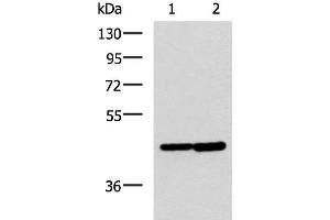 Western blot analysis of Hela and Jurkat cell lysates using LAMP3 Polyclonal Antibody at dilution of 1:600 (LAMP3 Antikörper)
