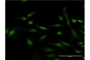 Immunofluorescence (IF) image for anti-DNA Meiotic Recombinase 1 (DMC1) (AA 237-339) antibody (ABIN524564)