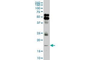 LMO2 monoclonal antibody (M05), clone 4D3. (LMO2 Antikörper  (AA 16-102))