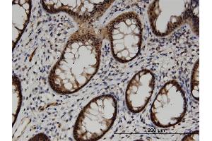 Immunoperoxidase of monoclonal antibody to ACOT7 on formalin-fixed paraffin-embedded human colon. (ACOT7 Antikörper  (AA 1-338))