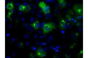 Anti-LIPG mouse monoclonal antibody (ABIN2453248) immunofluorescent staining of COS7 cells transiently transfected by pCMV6-ENTRY LIPG (RC209248). (LIPG Antikörper)