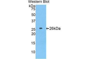 Western Blotting (WB) image for anti-Laminin, beta 2 (Laminin S) (LAMB2) (AA 1498-1716) antibody (ABIN1859603) (LAMB2 Antikörper  (AA 1498-1716))