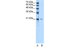 WB Suggested Anti-C20orf24 Antibody Titration:  2. (C20ORF24 Antikörper  (N-Term))