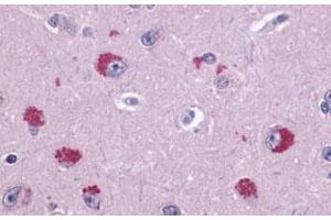 Immunohistochemical (Formalin/PFA-fixed paraffin-embedded sections) staining in human brain, neurons with TAAR1 polyclonal antibody . (TAAR1 Antikörper  (2nd Extracellular Domain))