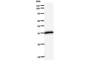 Western Blotting (WB) image for anti-SATB Homeobox 2 (SATB2) antibody (ABIN932998) (SATB2 Antikörper)