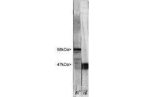 Western blot of whole rat cerebellum homogenate stained with ABIN1842266 in the left strip, at dilution of 1:20,000. (NEFL Antikörper)