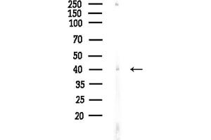 anti-Acyl-CoA Dehydrogenase, C-2 To C-3 Short Chain (Acads) antibody