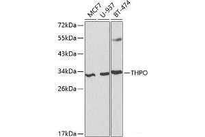 Western blot analysis of extracts of various cell lines using THPO Polyclonal Antibody at dilution of 1:1000. (Thrombopoietin Antikörper)