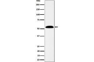 Western blot analysis of ALDH7A1 expression in SW480 cell lysate.