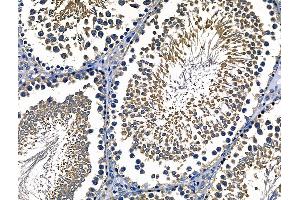 ABIN6262611 and ABIN6268701 at 1/100 staining Rat testis tissue by IHC-P.