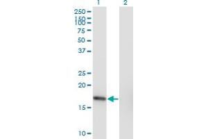 Western Blot analysis of SNX3 expression in transfected 293T cell line by SNX3 monoclonal antibody (M10), clone 3A9.