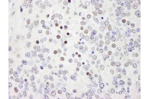 Immunohistochemistry (IHC) image for anti-Werner Helicase Interacting Protein 1 (WRNIP1) (AA 400-450) antibody (ABIN7449035) (WRNIP1 Antikörper  (AA 400-450))