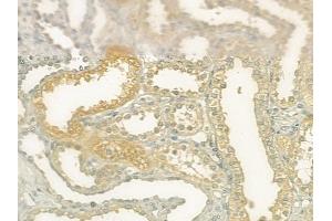 ABIN6264982 and ABIN6277611 at 1/100 staining human normal kidney tissue by IHC-P. (SEMG1 Antikörper  (C-Term))