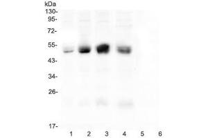 Western blot testing of CAR antibody and rat samples 1: pancreas (Coxsackie Adenovirus Receptor Antikörper  (C-Term))