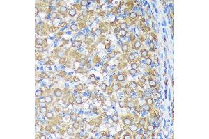 Immunohistochemistry (IHC) image for anti-Asparagine-Linked Glycosylation 5, Dolichyl-Phosphate beta-Glucosyltransferase Homolog (S. Cerevisiae) (ALG5) (AA 34-190) antibody (ABIN7265696)