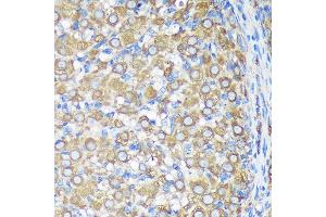Immunohistochemistry of paraffin-embedded Rat ovary using  Rabbit pAb (ABIN7265696) at dilution of 1:100 (40x lens).