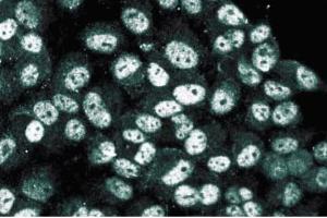 Immunofluorescence staining of human endothelial cells. (HDAC3 Antikörper  (AA 309-425))