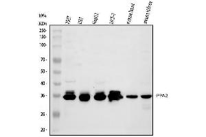 Western blot analysis of PPA2 using anti-PPA2 antibody (ABIN6719431).