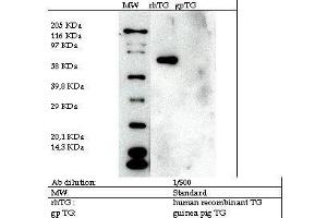 Image no. 2 for anti-Transglutaminase 2 (C Polypeptide, Protein-Glutamine-gamma-Glutamyltransferase) (TGM2) antibody (ABIN347018) (Transglutaminase 2 Antikörper)