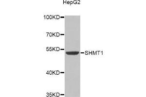 Western blot analysis of extracts of HepG2 cell line, using SHMT1 antibody. (SHMT1 Antikörper)