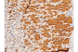 ABIN6267308 at 1/100 staining rat gastric tissue sections by IHC-P. (C-JUN Antikörper  (pTyr170))