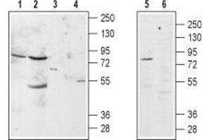 Western blot analysis of α1B-Adrenoceptor in rat brain (lanes 1 and 3), rat kidney (lanes 2 and 4) and GH3 cell line (lanes 5 and 6) lysates: - 1,2,5. (ADRA1B Antikörper  (Extracellular, N-Term))