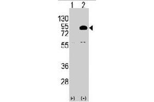 Western blot analysis of PIK3R2 polyclonal antibody  (arrow). (PIK3R2 Antikörper  (N-Term))
