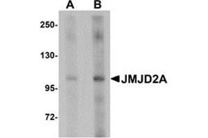 Western Blotting (WB) image for anti-Lysine (K)-Specific Demethylase 4A (KDM4A) (Middle Region) antibody (ABIN1030968) (KDM4A Antikörper  (Middle Region))